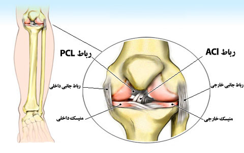 آسیب ناشی از فشار