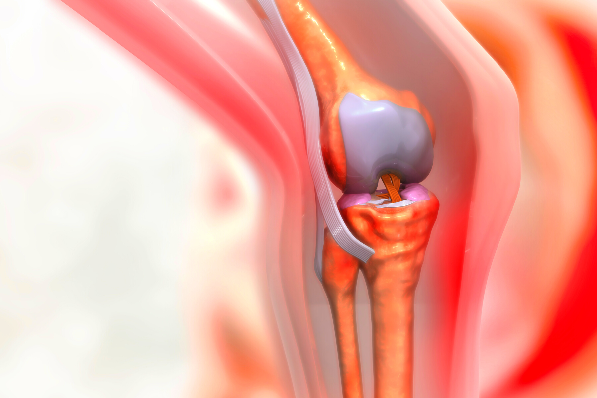 سوالات مهم درباره جراحی تعویض مفصل زانو