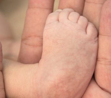 پاچنبری یا کلاب فوت؛ علت، پیشگیری و درمان
