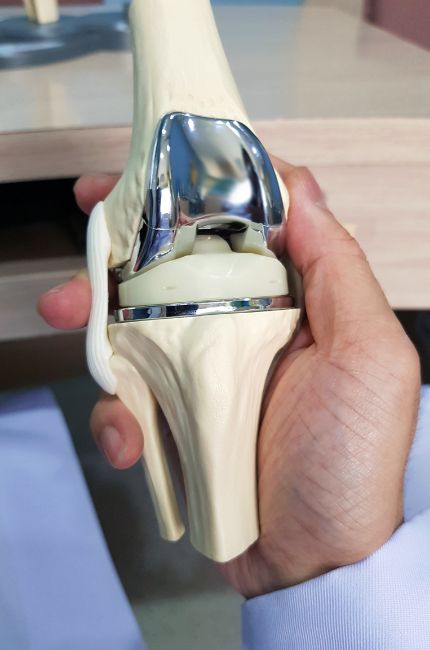 طول عمر پروتز زانو چقدر است؟